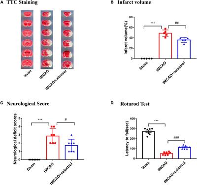 Effect of Celastrol on LncRNAs and mRNAs Profiles of Cerebral Ischemia-Reperfusion Injury in Transient Middle Cerebral Artery Occlusion Mice Model